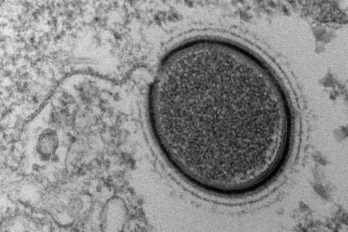 Зачем ученым воскрешать вирус-гигант возрастом 30 тысяч лет