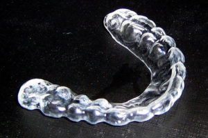 Вы знали, что зубы можно выровнять не только брекетами? Ортодонт советует элайнеры — они действуют быстрее и легко снимаются